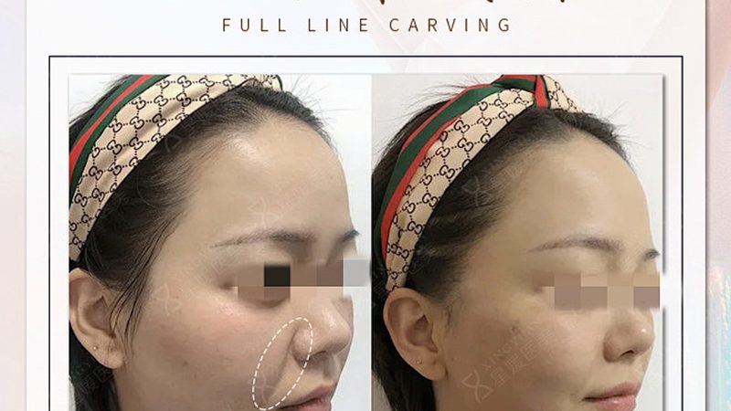 轻医美皮肤管理仪器参数对比