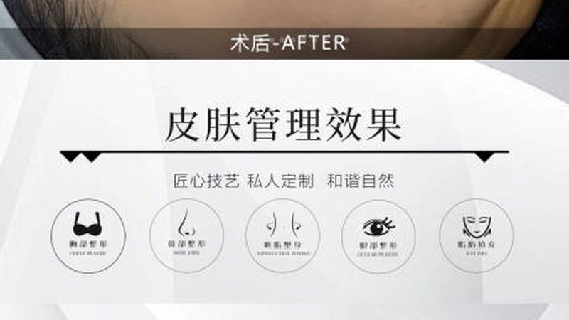 成都瘦腿针，你了解多少？**