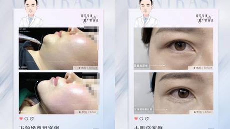 瘦脸按摩棒与美容仪：揭秘两者间的奥秘与差异