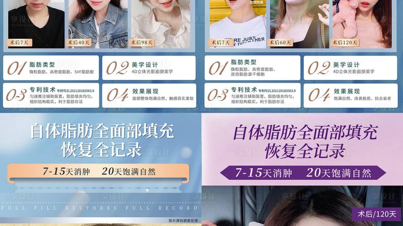 成都热玛吉2025价格解析：揭秘价格背后的秘密