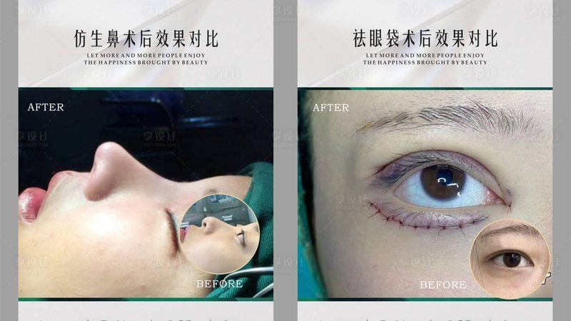 面部提升新趋势：不开刀的美丽秘籍
