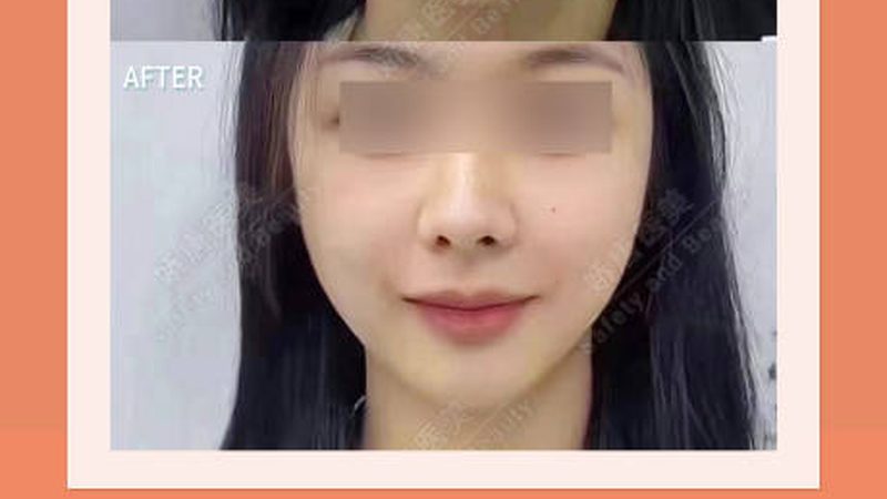 术前沟通不是走过场，而是手术的“第一刀