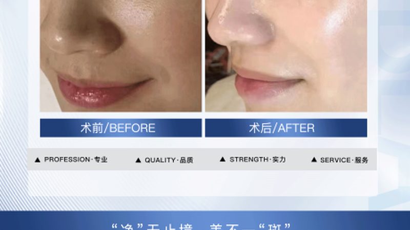 揭秘成都医美咨询师招聘骗局：如何识破陷阱，保护自身权益