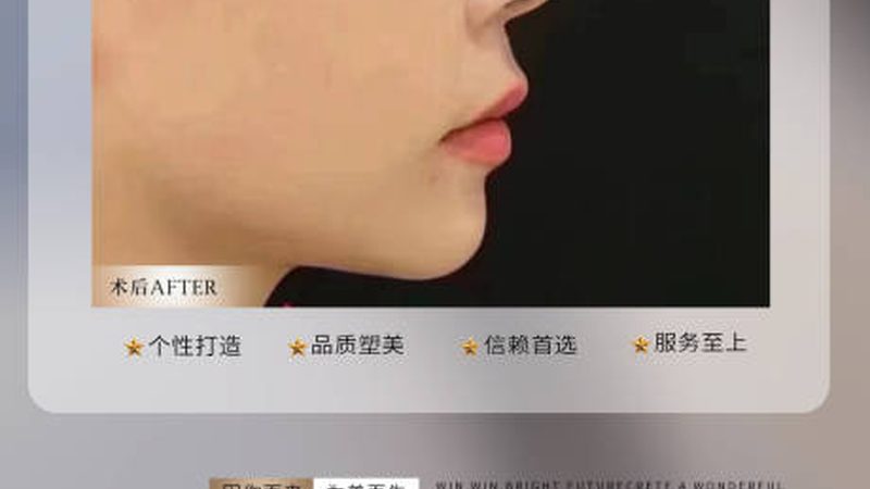 比基尼线脱毛加盟，费用背后的考量因素