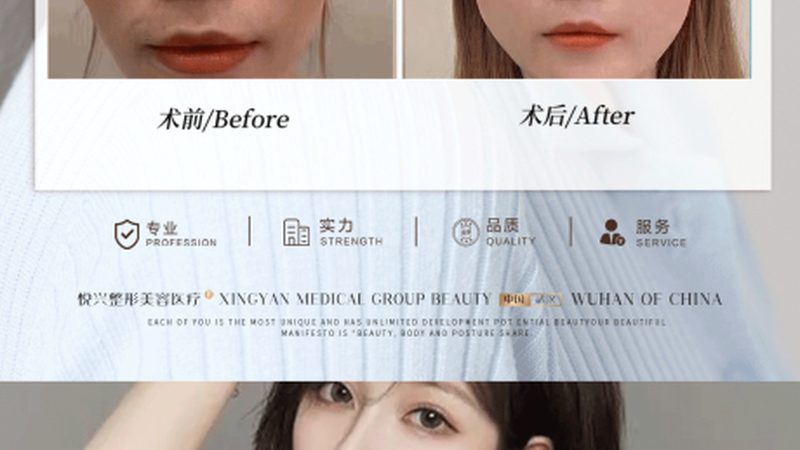 医美护肤，仪器选对是关键