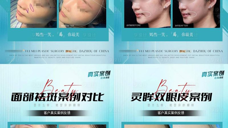 家用激光脱毛仪如何挑选？揭秘十大品牌背后的秘密