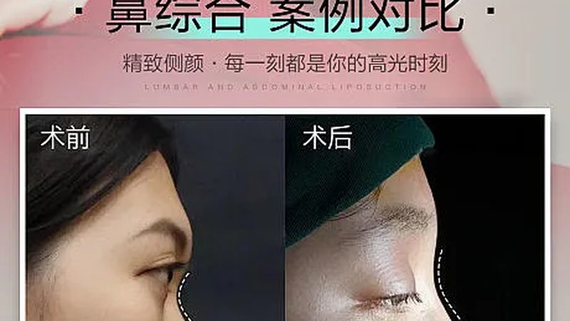 医美加盟代理：揭秘行业背后的运营之道
