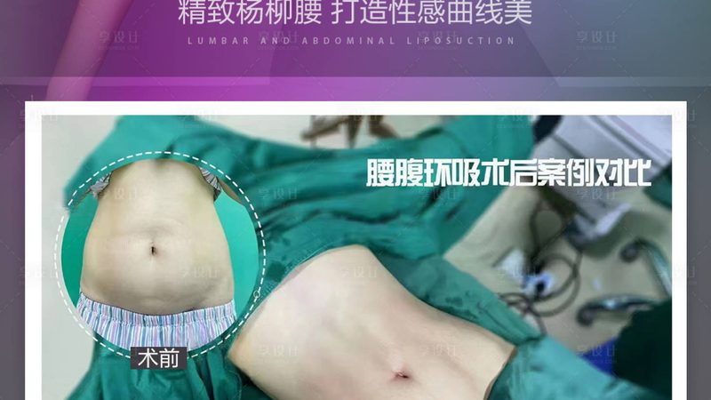 超声炮与热玛吉去眼袋：技术对比解析