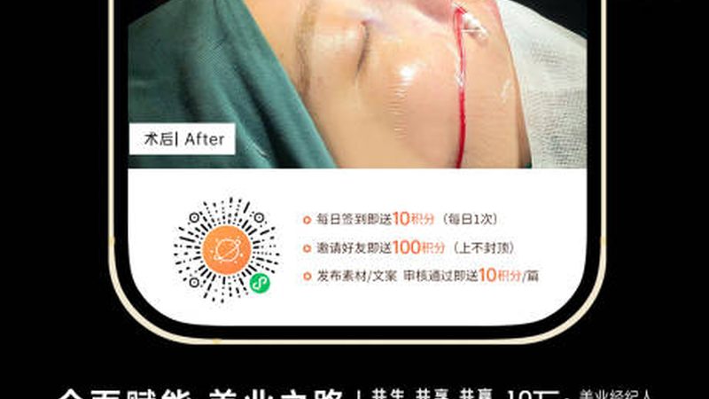 小标题：家用激光美容仪的兴起