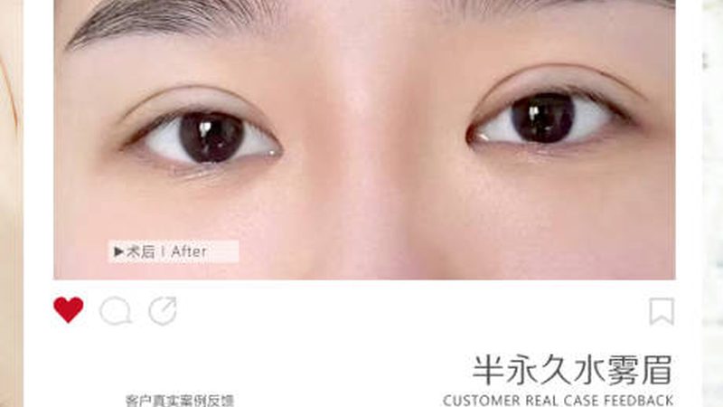 揭秘广州水光针：揭秘其生产工艺与品质标准