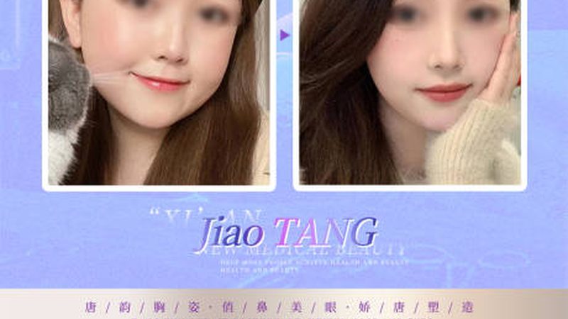 北京下颌角截骨失败修复，揭秘价格背后的真相