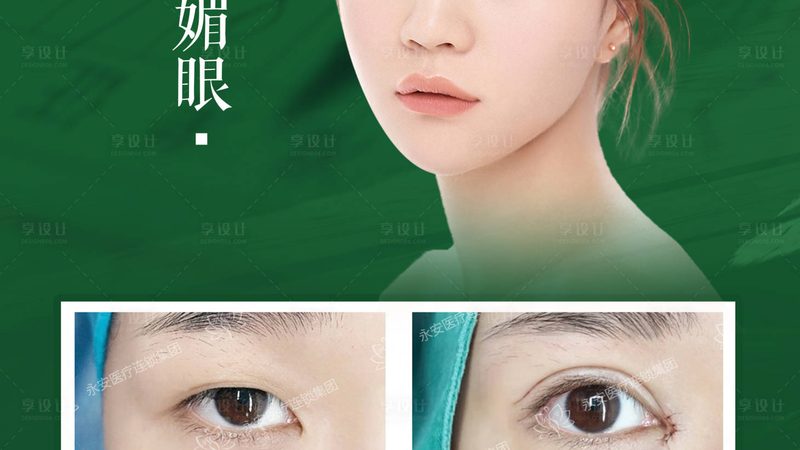 玻尿酸代理，成都哪家正规？揭秘合规选购指南