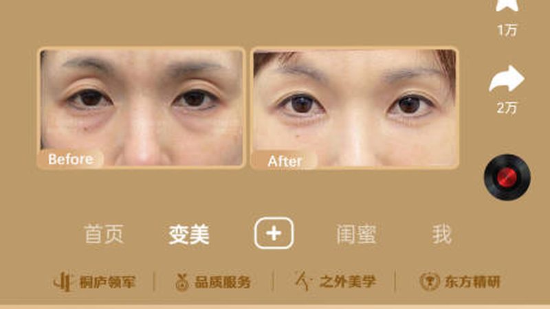 超声炮加盟代理，揭秘费用构成与选型要点