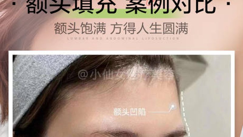 激光美容祛斑仪器型号参数大全